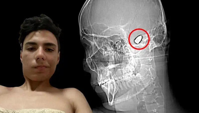 Kafasında Patlayan Bombanın Hikayesi: Psikolojik Savaş Nereye Gidiyor?