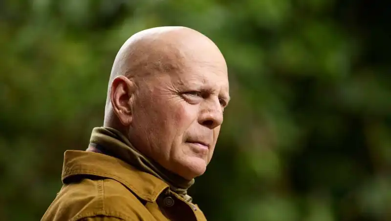 Bruce Willis'in Hastalığı: Afazi Hakkında Bilinmesi Gereken Her Şey