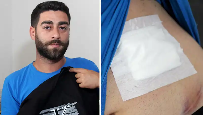 Karnında Ağrı Hissetti, Röntgen Sonrasında Şok Edici Gerçek Ortaya Çıktı
