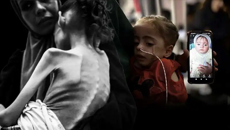 Küçük Meryem'in Açlıkla Mücadelesi: 25 Kilodan 10 Kiloya Düştü!