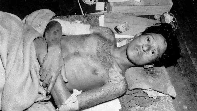 80 Yıl Sonra Nagasaki’den Şok Çağrı: Nükleer Felaket Tehdidi