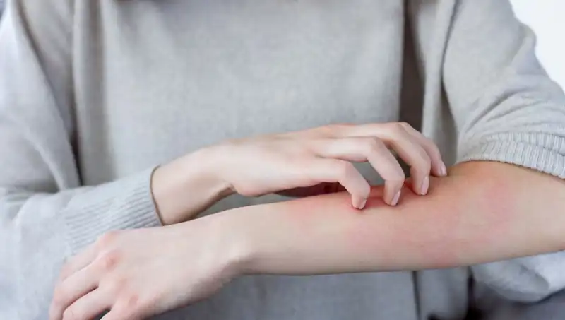 Cilt Kanseri Belirtilerini Gözden Kaçırmayın: Dermatolog Açıklıyor!